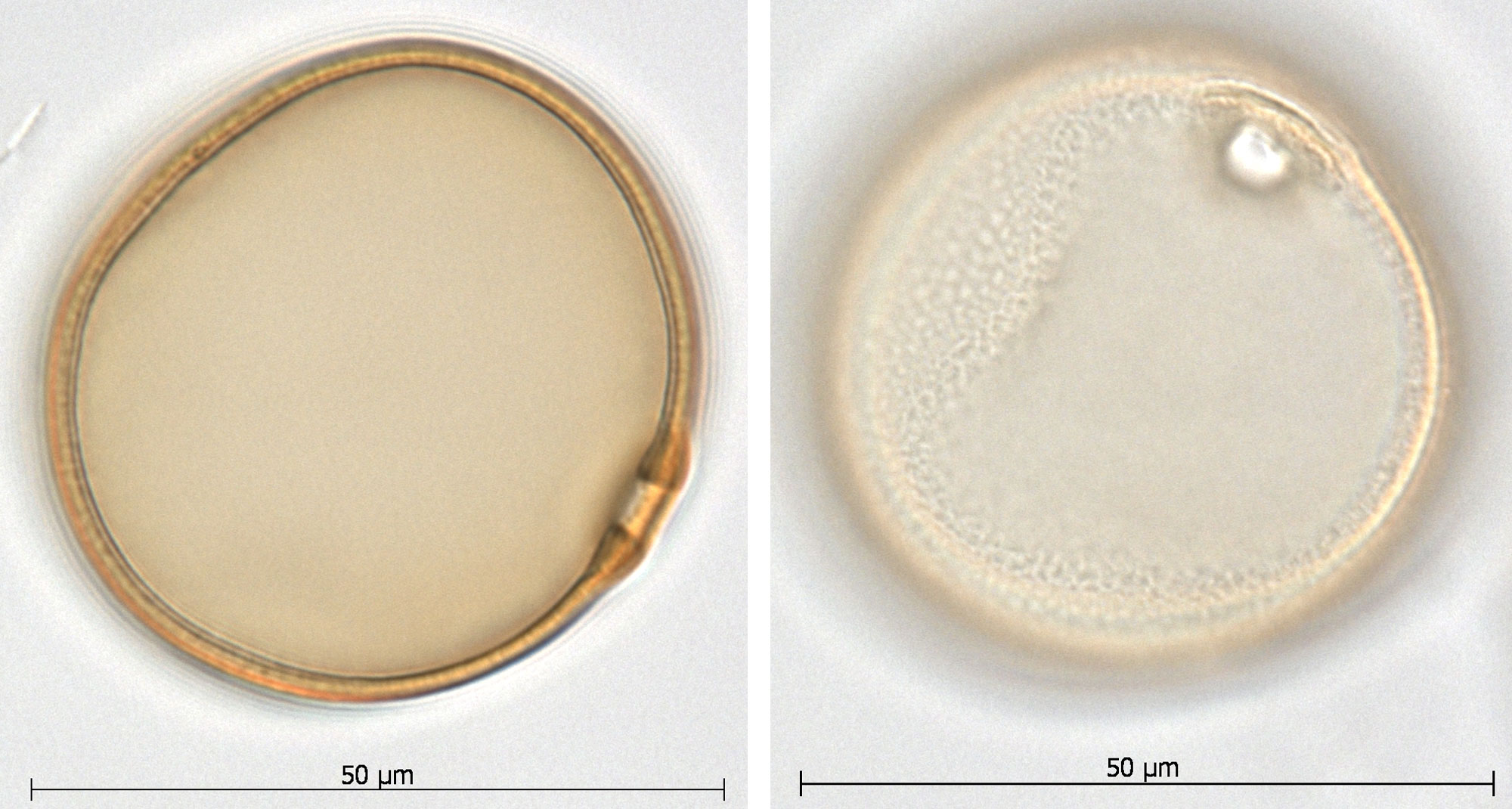 2-panel image showing photos of a tangelhead pollen grain taken under a microscope. Panel 1: Grain shown in side view with pore near the lower right. Panel 2: Grain focused to show pebbly surface and single small round pore, which is near the upper right. Both image show the grain is about 50 microns in diameter.