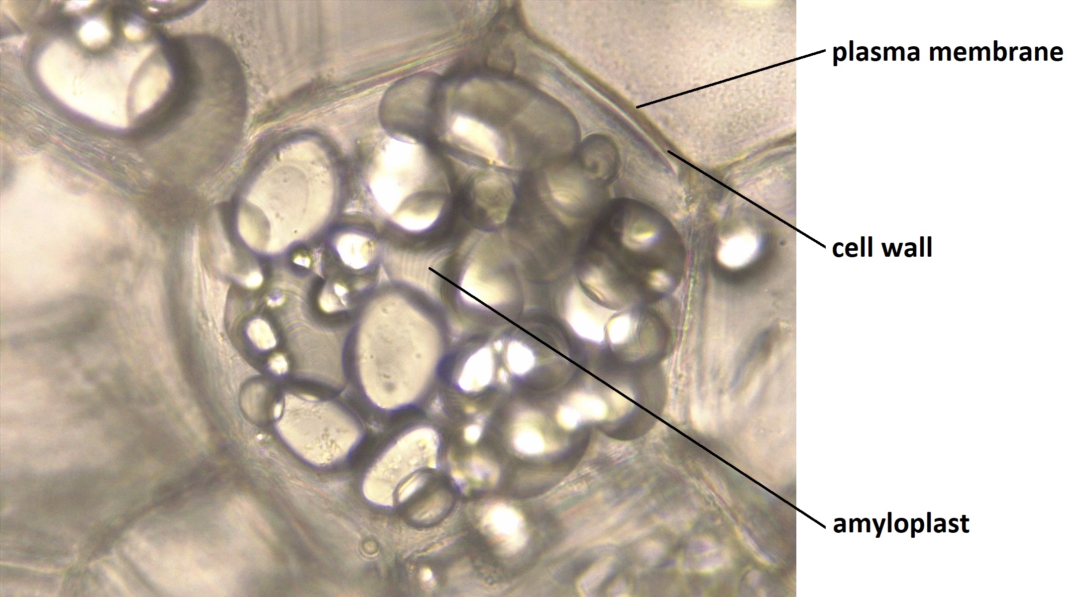 Photograph showing a plant cell containing amyloplasts. The phot shows a isodiametric, polygonal cell with circular to oval starch bodies in it.
