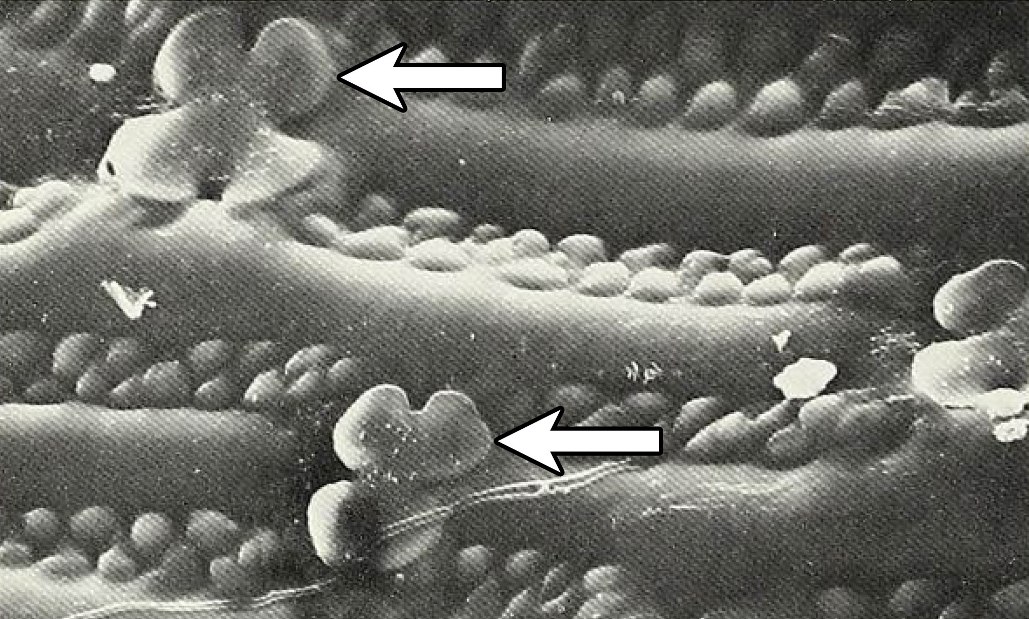 Grayscale scanning electron photomicrograph of the epidermis of the African grass Phacelurus huillensis showing silica bodies or phytoliths. The silica bodies are cross-shaped, with four rounded lobes.