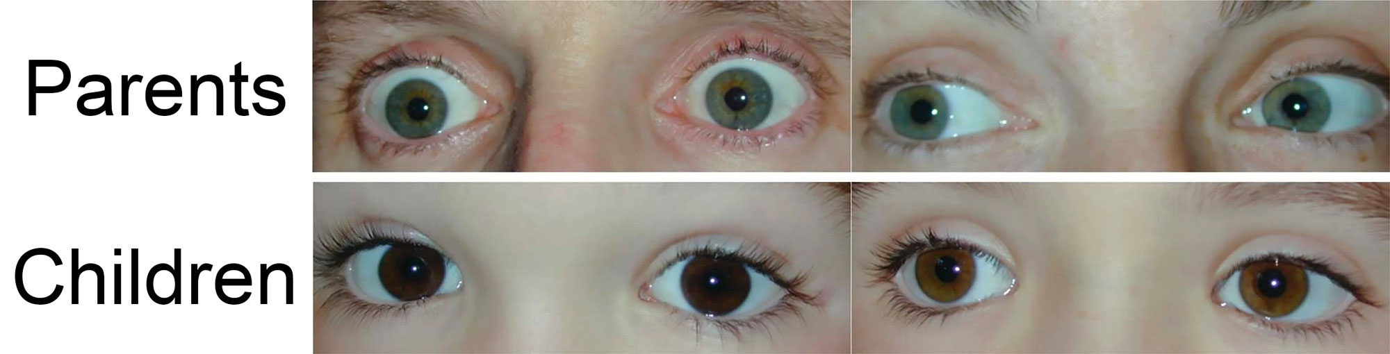 Two pairs of photographs showing eye color in a pair of parents and their two children. The parents each have blue-green eyes, whereas the children and medium to dark brown eyes.