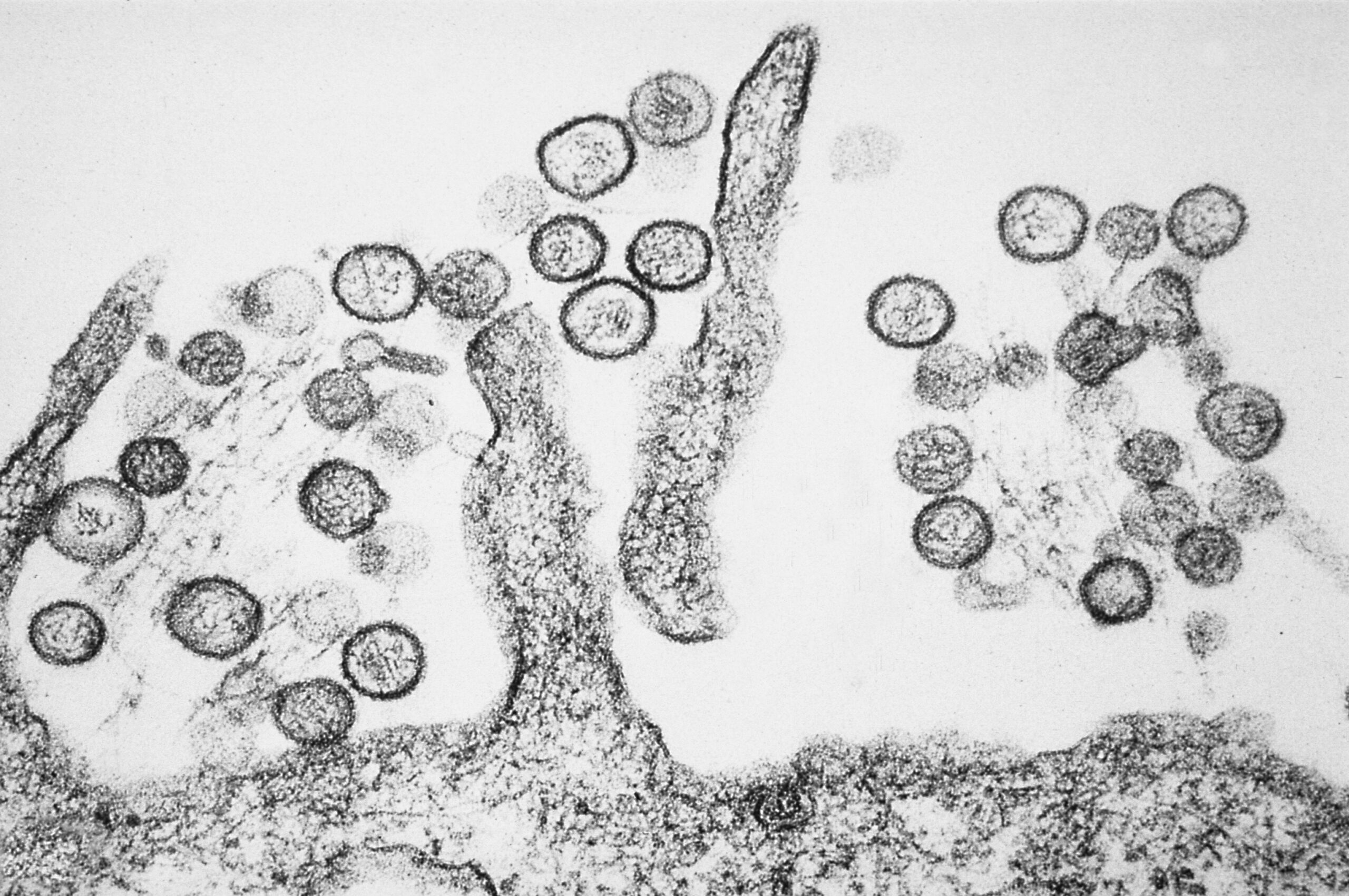 Transmission electron micrograph of the Sin Nombre hantavirus.